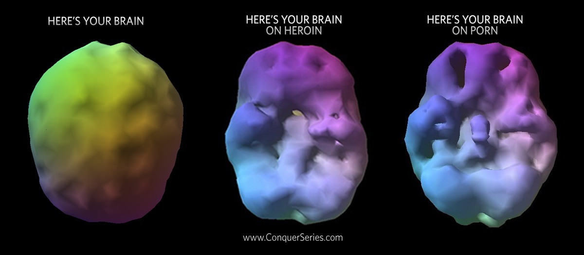 Your Brain on Porn.